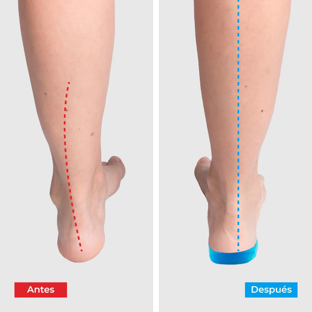 Plantillas Ortopédicas ConfortFeet® - Disfruta de días sin dolor, sin tratamientos caros ni visitas al médico
