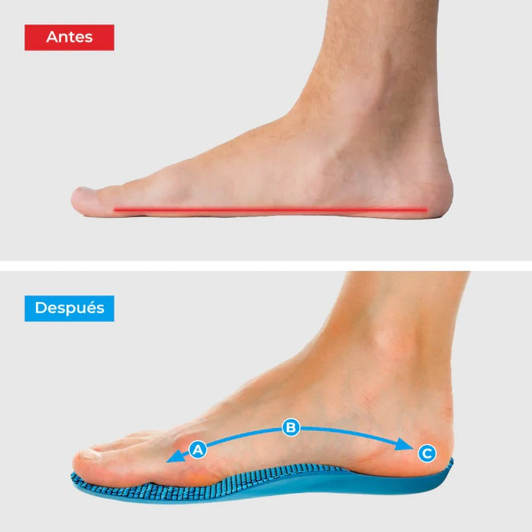 Plantillas Ortopédicas ConfortFeet® - Disfruta de días sin dolor, sin tratamientos caros ni visitas al médico