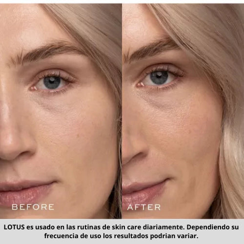 LOTUS® Renueva, Rejuvenece y Revitaliza Cada Día