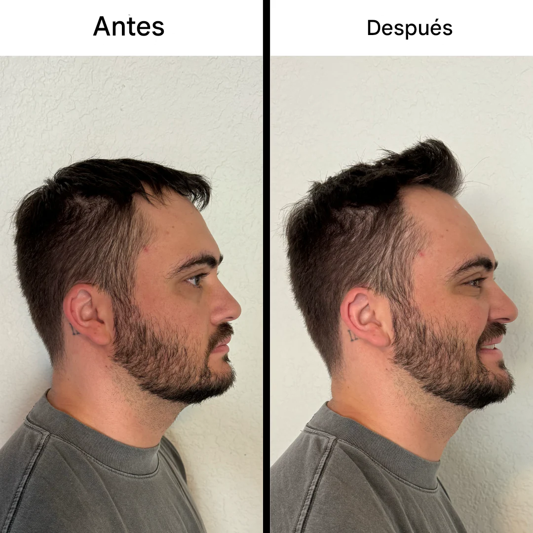 Mecow®: Voluminizador De Cabello En Polvo | Compre 2 Lleve 1 GRATIS