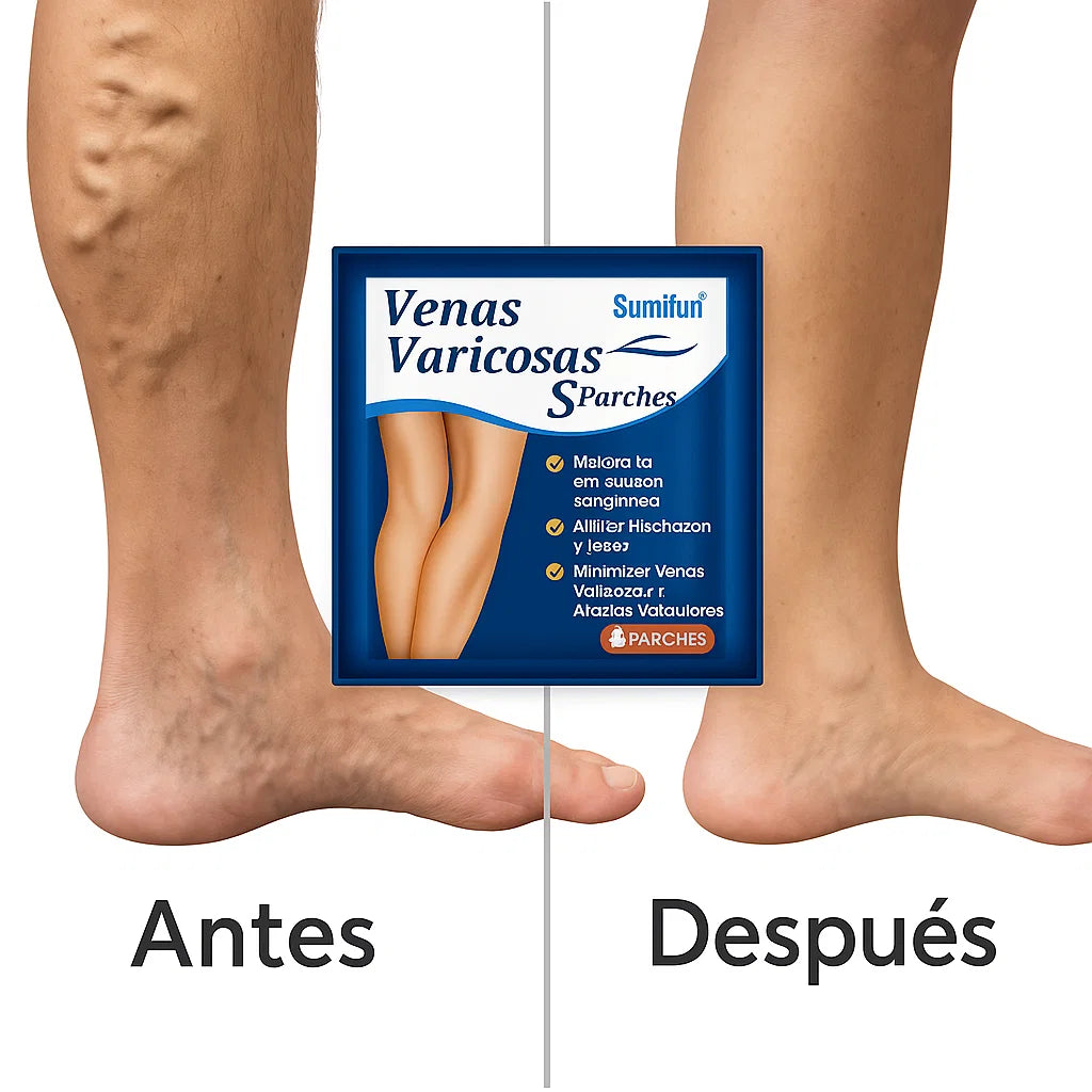 Varicose Veins Active™ – Piernas ligeras y activas todo el día.
