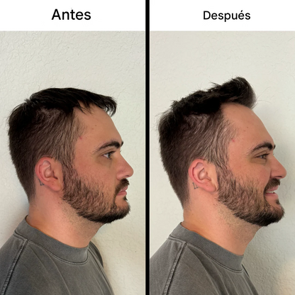 Mecow®: Voluminizador De Cabello En Polvo | Compre 2 Lleve 1 GRATIS