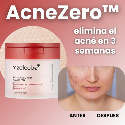 AcneZero™ Almohadillas coreanas – Piel limpia, libre de grasa y sin granos 70 unidades